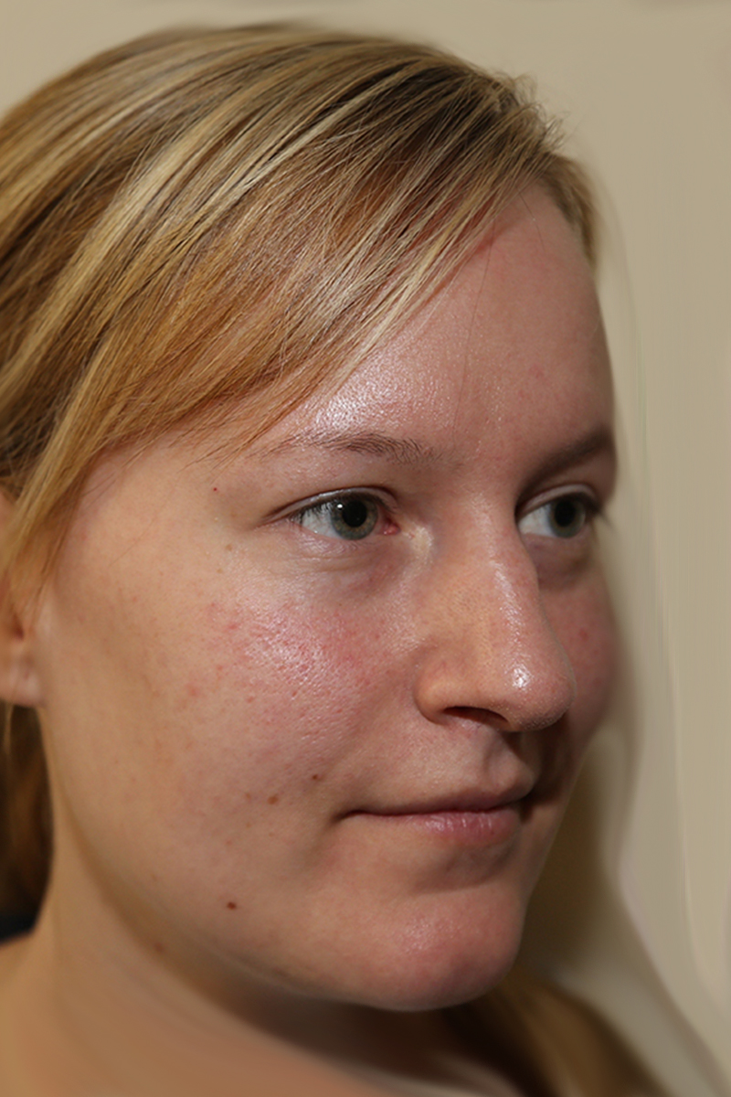 View 2 — before (pre-operative)