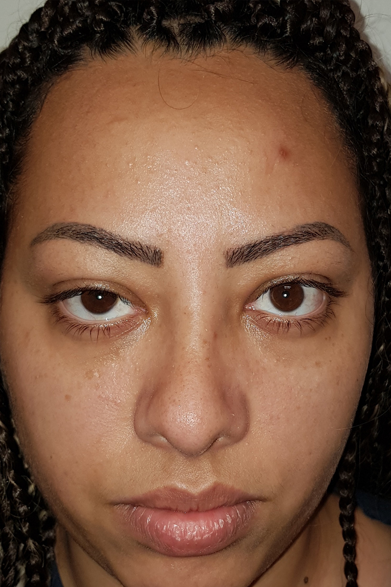 View 2 — after (post-operative)