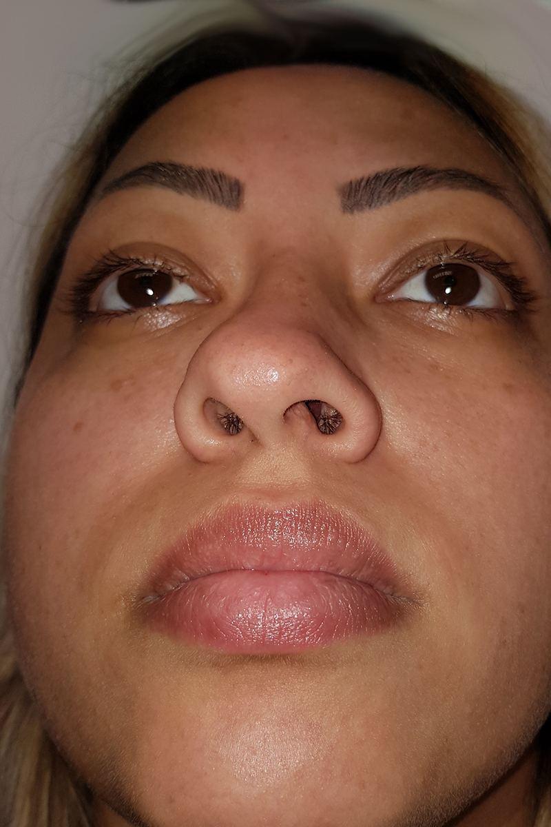 View 1 — before (pre-operative)