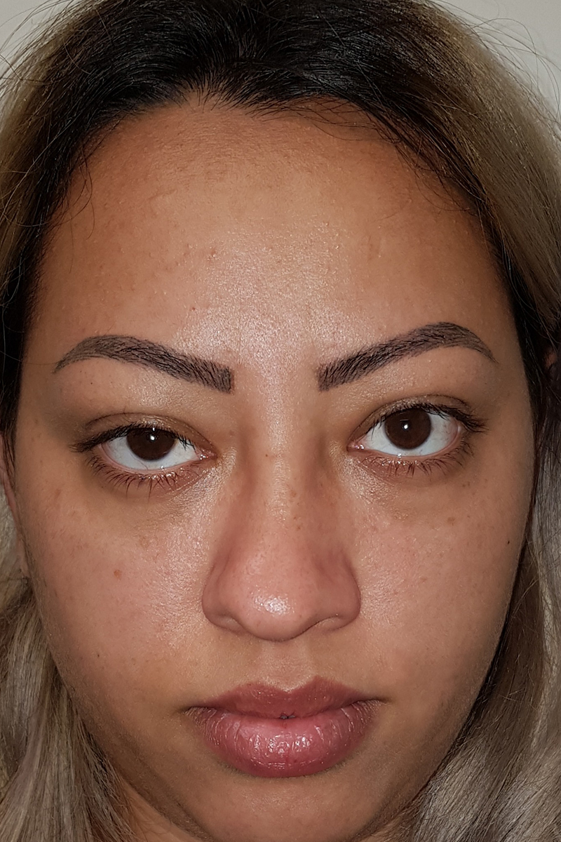 View 2 — before (pre-operative)