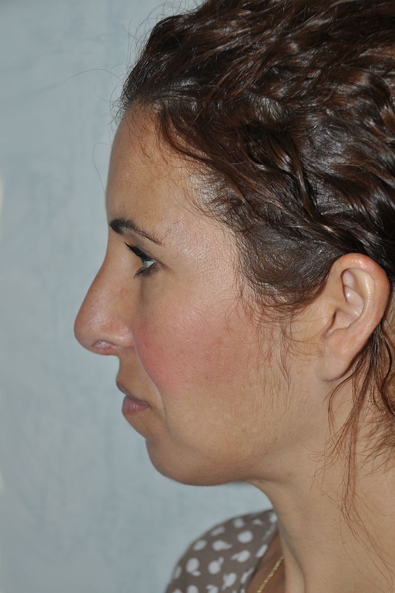 View 2 — after (post-operative)