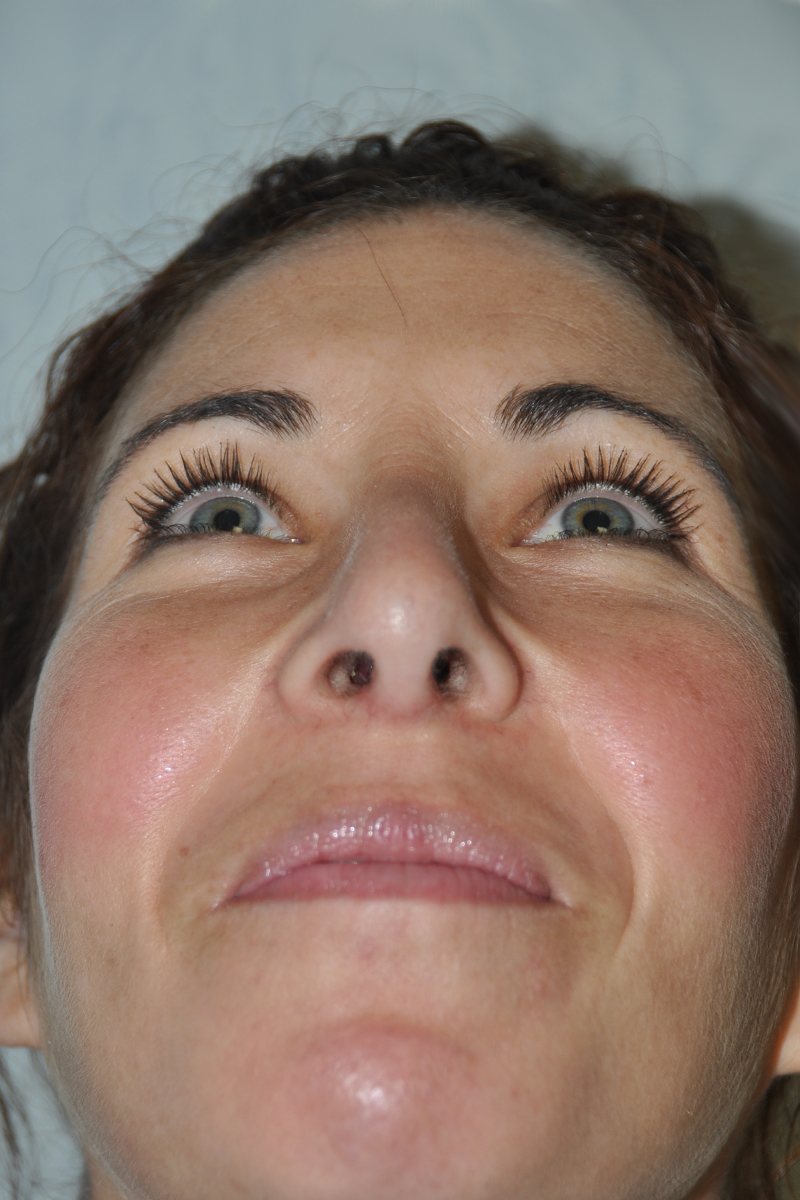 View 3 — after (post-operative)