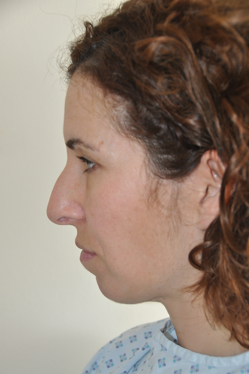 View 2 — before (pre-operative)