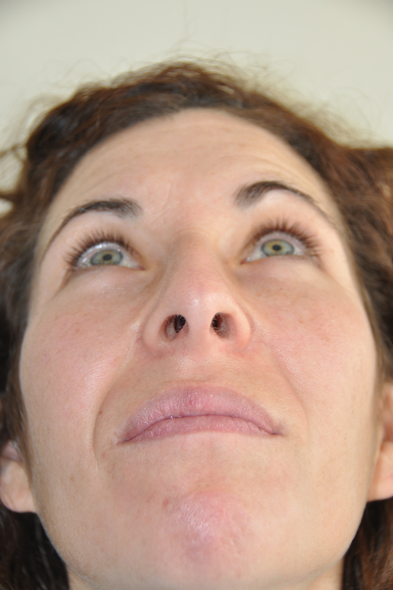 View 3 — before (pre-operative)
