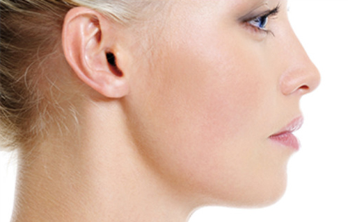 Chin surgery patient gallery category