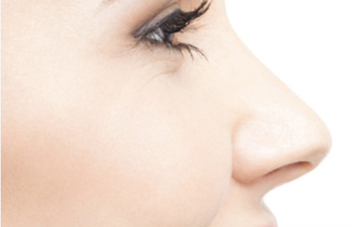 Rhinoplasty patient gallery category